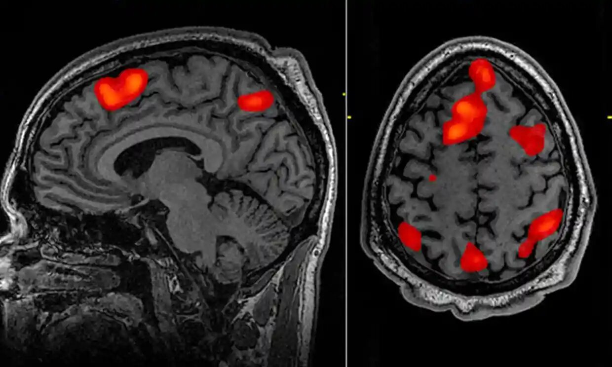 Breakthroughs in mind-reading AI promise world of possibilities
