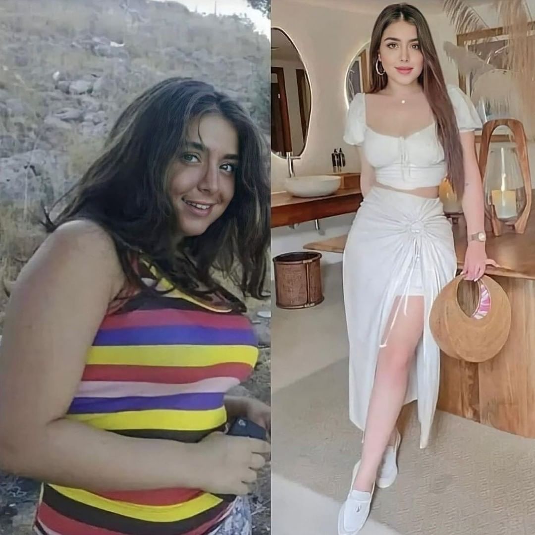Haya Maraachli before and after هيا مرعشلي قبل وبعد