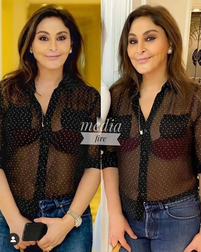 ""elissa sheer bra dubai golden residency small boobs new face plastic surgery before and after