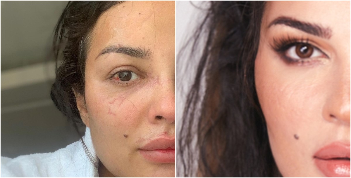 Nadine Njeim bruised face