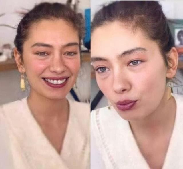 Neslihan Atagül Travels to England for Treatment