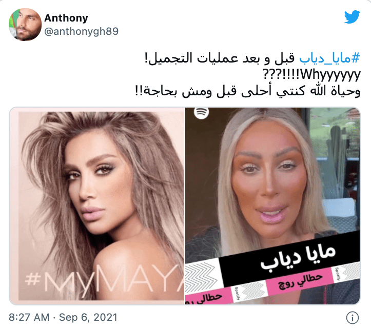 maya diab before after botox filler plastic surgery