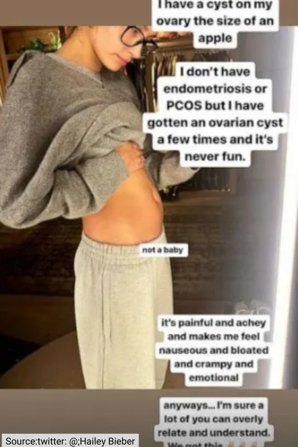 Hailey Bieber