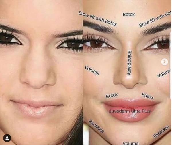 كيندال جينر