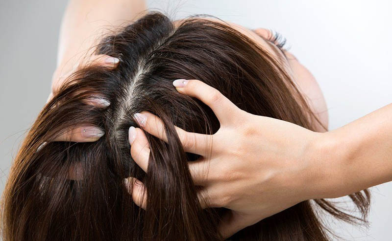 القمل في المنام للمطلقة