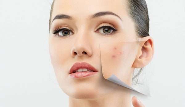 نصائح للتخلص بطريقة صحيحة من حبوب الوجه