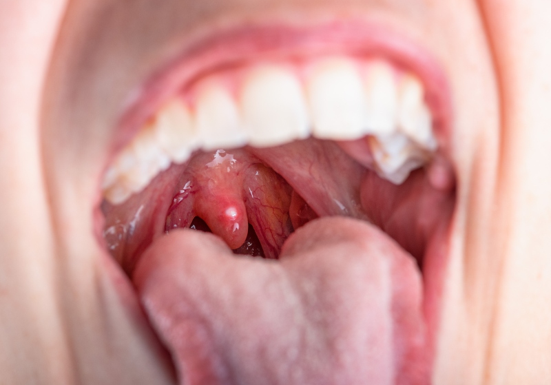بلع اللسان للاعبين كرة القدم: الأسباب وطرق العلاج