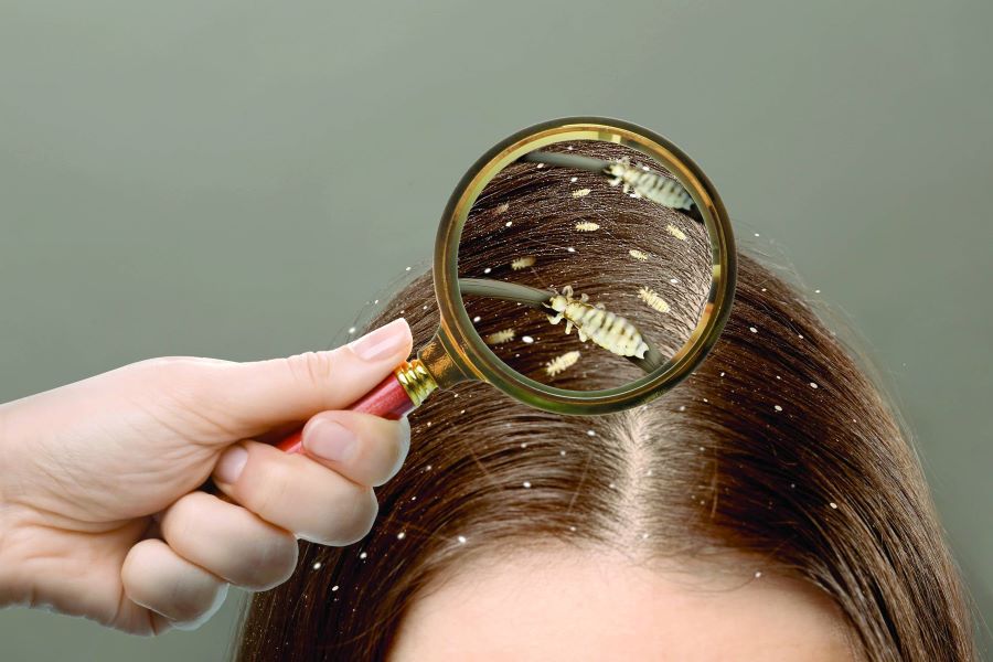 تفسير حلم رؤية القمل في شعر شخص آخر للعزباء