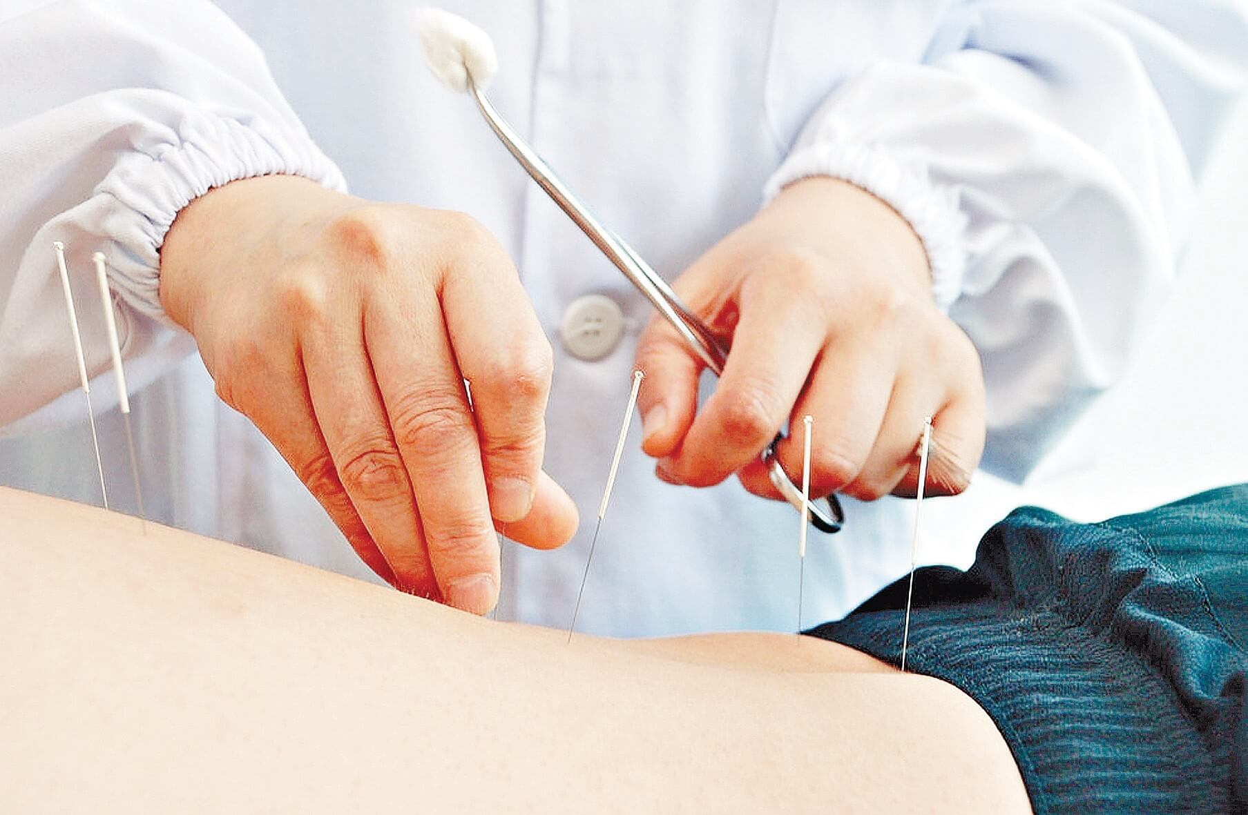 عيادة Natural Healing Acupuncture & Hijama Medical Center