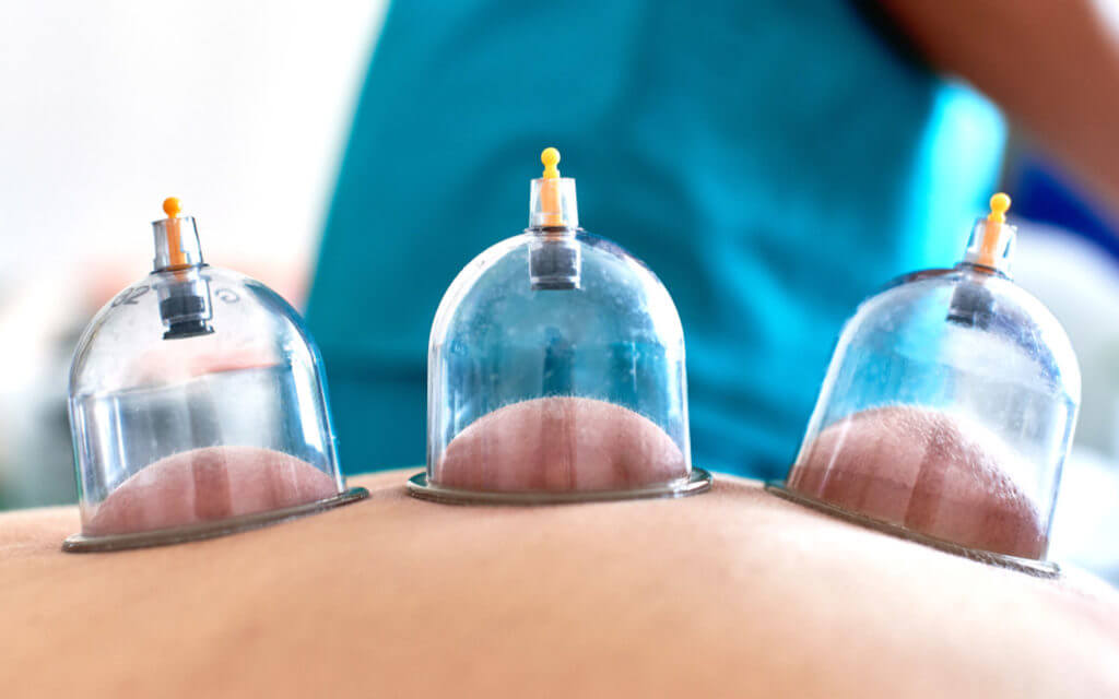 مركز الدليل الطبي للحجامة دبي