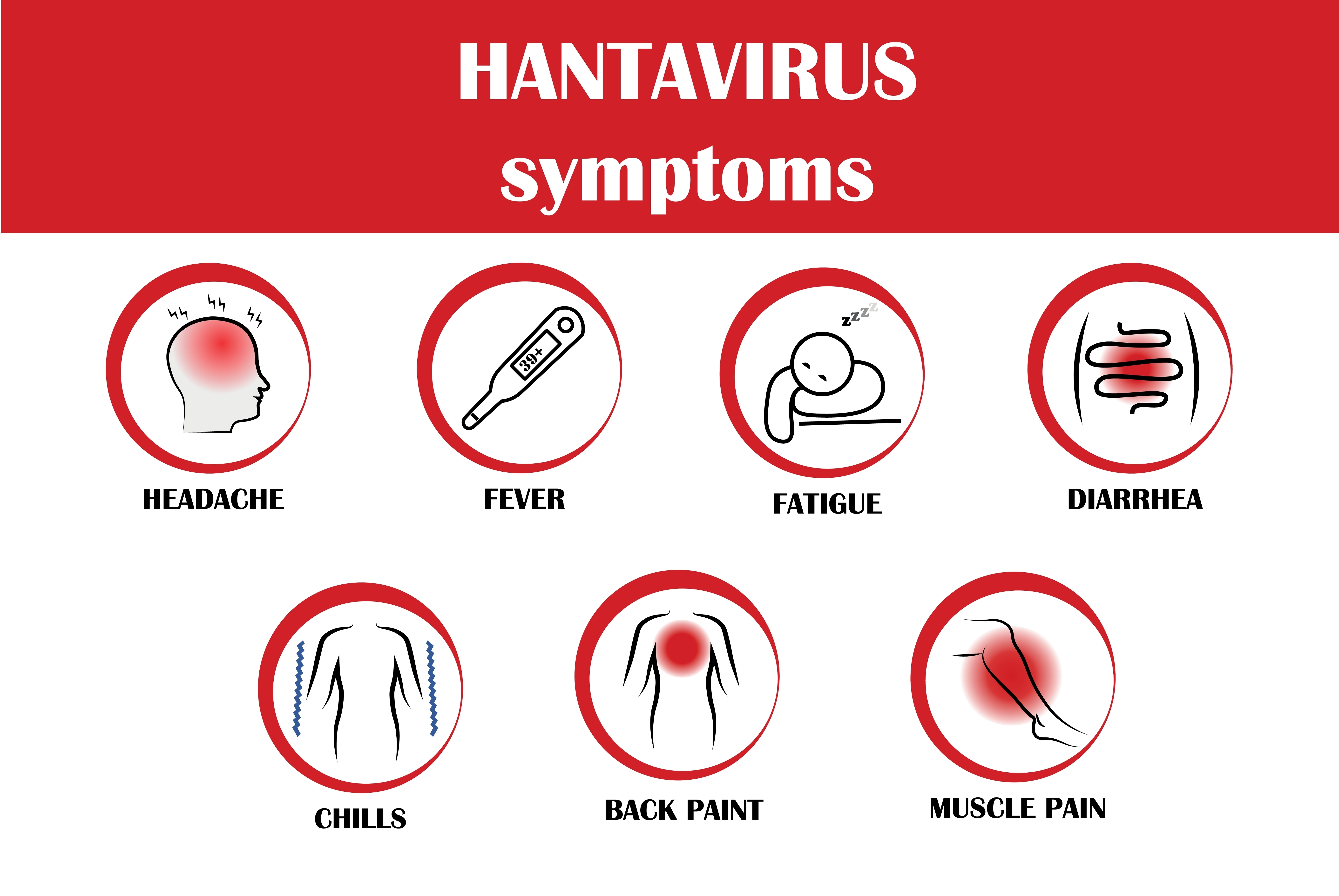 Hantavirus disease