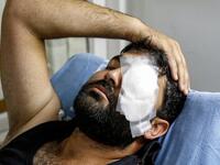 Palestinian photojournalist Muath Amarneh lost his left eye yesterday by Israeli sniper fire while covering protests in Surif near Al-Khalil (Hebron)(Twitter)