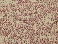 Pictures clicked by my daughter Surabhi Agarwal from window in Navi Mumbai of Wetlands in Seawods forming part of National Wetlands Atlas  (Twitter)