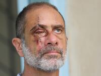 Rony Mecattaf, 59-year-old psychotherapist who lost his right eye in the August 4 cataclysmic explosion, poses for a picture at his psychotherapy clinic in Beirut's neighbourhood of Ashrafieh on August 15, 2020. ANWAR AMRO / AFP