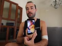 Lebanese makeup artist Sharbel Hasbany, 29, who was injured in the massive Beirut port explosion, displays an image on his phone of himself after the blast, during an interview at home in the Sin el-Fil neighbourhood of the Lebanese capital, on August 16, 2020. ANWAR AMRO / AFP