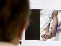 Lebanese doctor Selim Nasser displays the image of a patient's body who was hit by small lead pellets. ANWAR AMRO / AFP