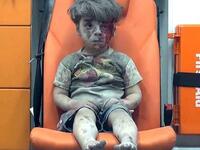 الطفل السوري عمران، الذي أصبحت صورته رمزًا للحرب في سوريا بعد لحظات من انتشاله من تحت أنقاض مبنى منهار. كان هذا في أغسطس عام 2016.