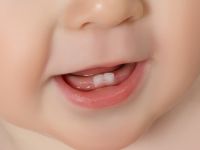 كيف تحافظين على أسنان طفلك منذ ظهورها الأولى؟