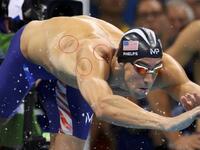 أثار السباح الأميركي مايكل فيلبس، المتوج في أولمبياد ريو دي جانيرو بذهبيته التاسعة عشرة في الألعاب الأولمبية، الفضول بنقاط دائرية داكنة على كتفيه. وظهرت أيضا على كتفي لاعب الجمباز أليكس ندور، لكنها ليست نتيجة تمارين، بل بسبب اللجوء الى علاج الطب البديل: الحجامة