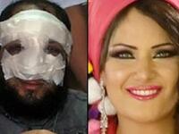 Anwar al-Balkimy post-nose-op and his rumored belly-dancer wife