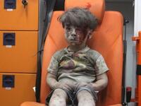 الطفل عمران (5 أعوام) تصدرت صورته وسائل الإعلام العالمية، وتم إنقاذه من تحت أنقاض أحد المباني المهدمة في المنطقة الشرقية لحلب في سوريا، وظهر عمران في الصورة شارداً مذهولاً وهو جالس على كرسي عربة الإسعاف.