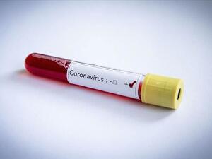 Staffer self isolating at home, starts medication, club confirms (Photo: AA)