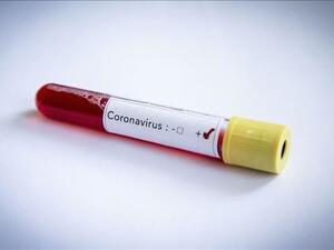 Total number of cases at Istanbul football club rises to 5 (Photo: AA)