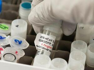 كم من المتوقع أن تبلغ مبيعات فايزر وموديرنا من لقاح كورونا؟