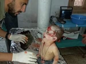 طفل ‫هشم الطيران رأسه ومزّق أصابع رجليه وكسر أسنانه ، لكنه ببراءته يضحك للطبيب 