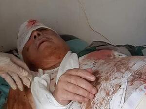 علي كيالي  واصابات بالغة 