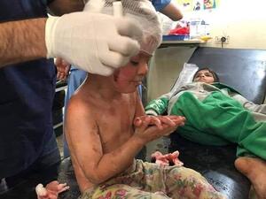 الصور الاولية للقصف التركي على مدينة سري كانية