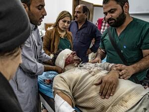 A Syrian Arab man injured by an explosion while entering the town of Ras Al-Ain, during the ceasefire amidst the ongoing Turkish offensive against Kurdish-controlled areas of northeastern Syria, receives medical treatment at a hospital in nearby Tal Tamr on October 22, 2019. (Delil SOULEIMAN / AFP)