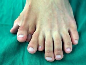 Ajun, 21, from Lufeng City, southern China, was born with a severe deformity which caused him to suffer with nine toes on his left food (dailymail)