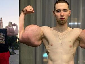 The disastrous implants were causing Mr Tereshin 'high fever, strong pain, and weakness'. (Alana Mamaeva)