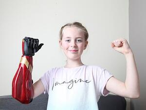 Hollie Lownds, 11, was left 'speechless' when she tried on her bionic arm (pictured) for the first time, paid for by an anonymous donor (dailymail)