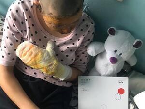 Anna Krytska, 16, recovering in hospital after she was doused in petrol and set alight by her father when she tried to stop him beating up her mother. Daily Mail