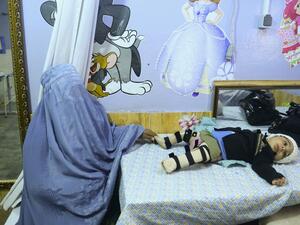 In this photo taken on February 2, 2020, a woman wearing a burqa sits next to her disable child at the International Committee of Red Cross (ICRC) hospital in Herat province. HOSHANG HASHIMI / AFP