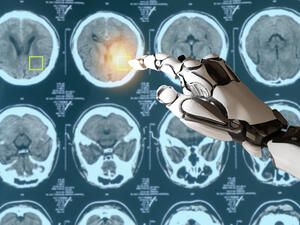 How Cutting Edge Technology is Revolutionizing Cancer Treatment as We Know It