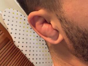 موضة "كسر الأذن"