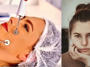 العلاج بالنبضات الكهربائية