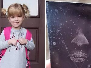 الطفلة الصغيرة "جيليان"