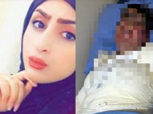 Set on Fire by Husband: Iraqi Victim Sparks Social Media Calls for Women's Protection