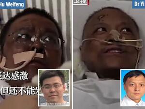 الطبيبان "يي فان" و"هو ويفينغ"