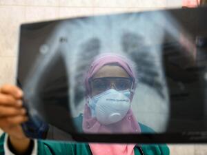 In this file photo taken on April 19, 2020, an Egyptian doctor wearing two protective masks checks a patient's lung X-ray at the infectious diseases unit of the Imbaba hospital in the capital Cairo, during the COVID-19 coronavirus pandemic crisis. Months after Egypt reported its first coronavirus case, experts say the health system is approaching a "critical threshold" in its capacity to tackle the disease. The Arab world's most populous country of 100 million inhabitants has so far declared JUST OVER 12,00