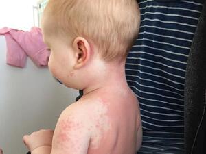 Eight month old Alexander Parsons (Twitter)