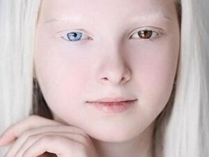 أمينا أرساكوفا