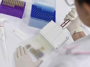 In this file photo taken on March 26, 2020 a researcher works on the diagnosis of suspected coronavirus COVID-19 cases in Belo Horizonte, state of Minas Gerais, Brazil, on March 26, 2020. Douglas MAGNO / AFP