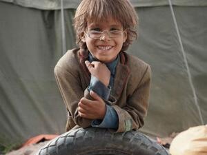 الطفل اليمني محمد 