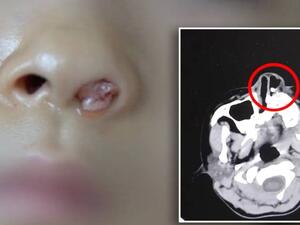 حالة طبية نادرة