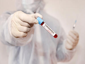 (Shutterstock/ File Photo)